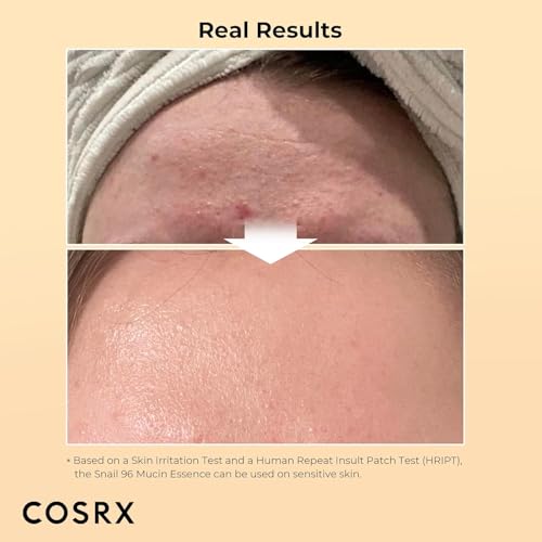 COSRX Snail Mucin 96% Power Repairing Essence for Dry Skin & Fine Lines
| COSRX Snail Mucin 96% Hydrating Serum for Dul